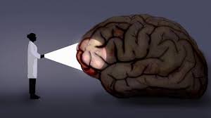 psychische krankheiten